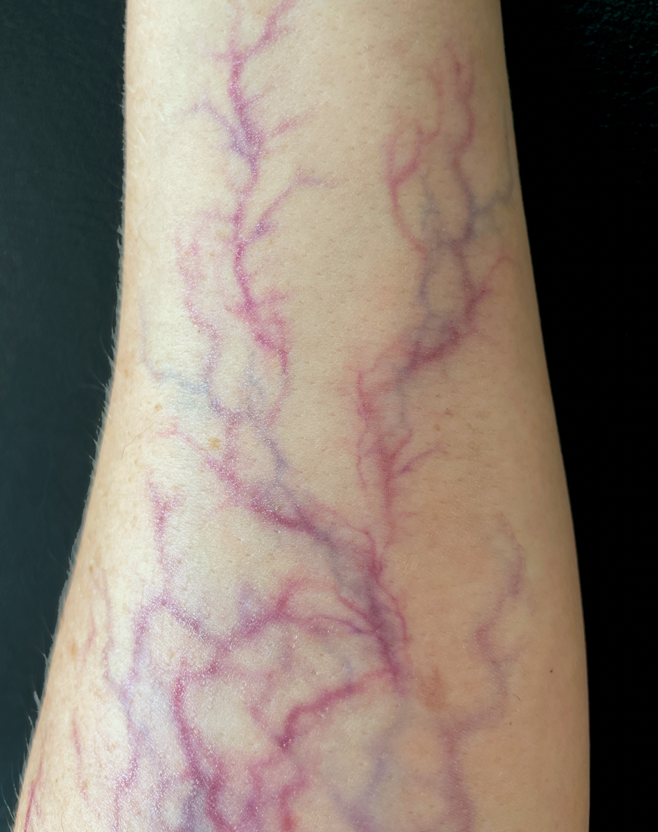 Veins - Natural Medium Size