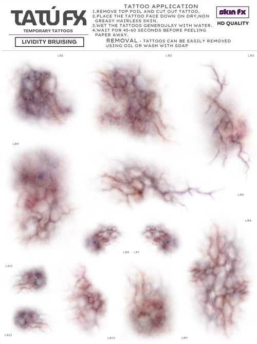 Bruising - lividity